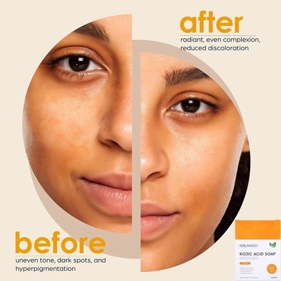 𝓢𝓮𝓻𝓾𝓶𝓲𝔃𝓮𝓭®️Dark Spot Remover Soap Bars - Picture 5 of 13